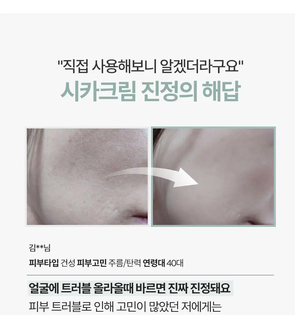 [리아킴PICK] NDP 엔디피 시카 바이오 플라센타 수분진정 크림 50ml 상세페이지 8